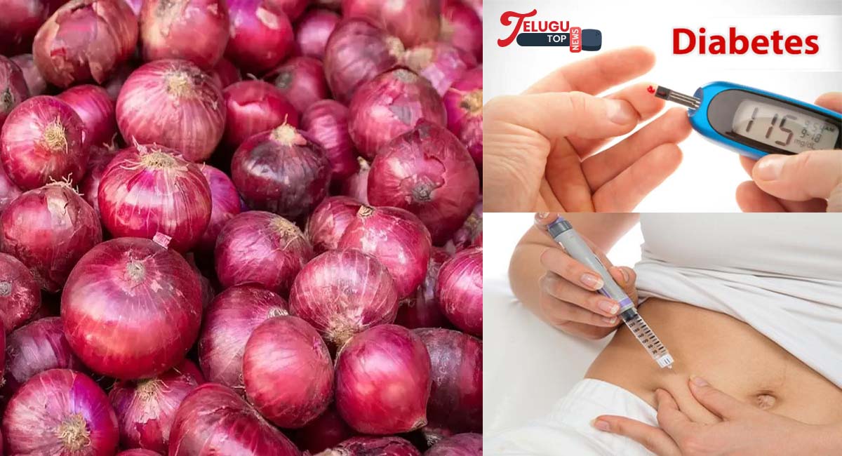 Raw Onion cures Diabetis : పచ్చి ఉల్లిపాయతో డయాబెటిస్ కు చెక్ పెట్టవచ్చని మీకు తెలుసా ..?