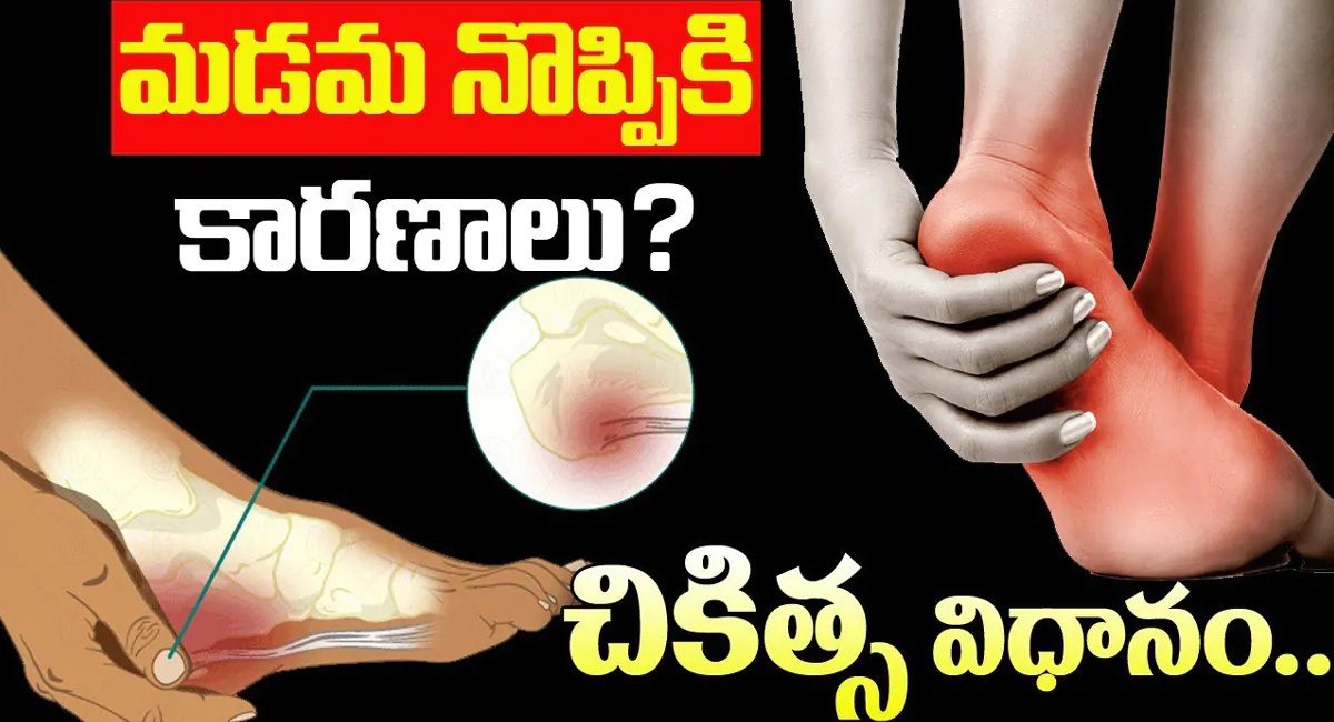 Heel Pain : మడవ నొప్పి రావడానికి కారణాలు ఏంటి..?ఇంట్లోనే చికిత్స విధానం ఎలా…?